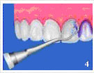 110_Чистка зубов 4.jpg